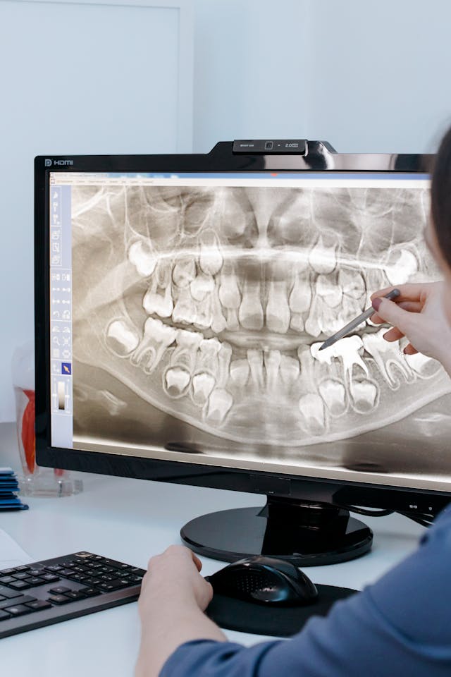 Digital Radiographs